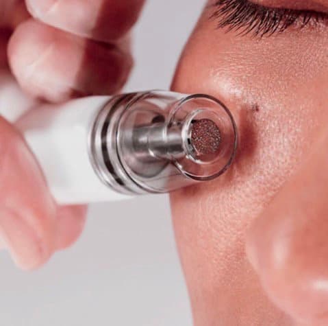 SilkPeel Dermal Infusion