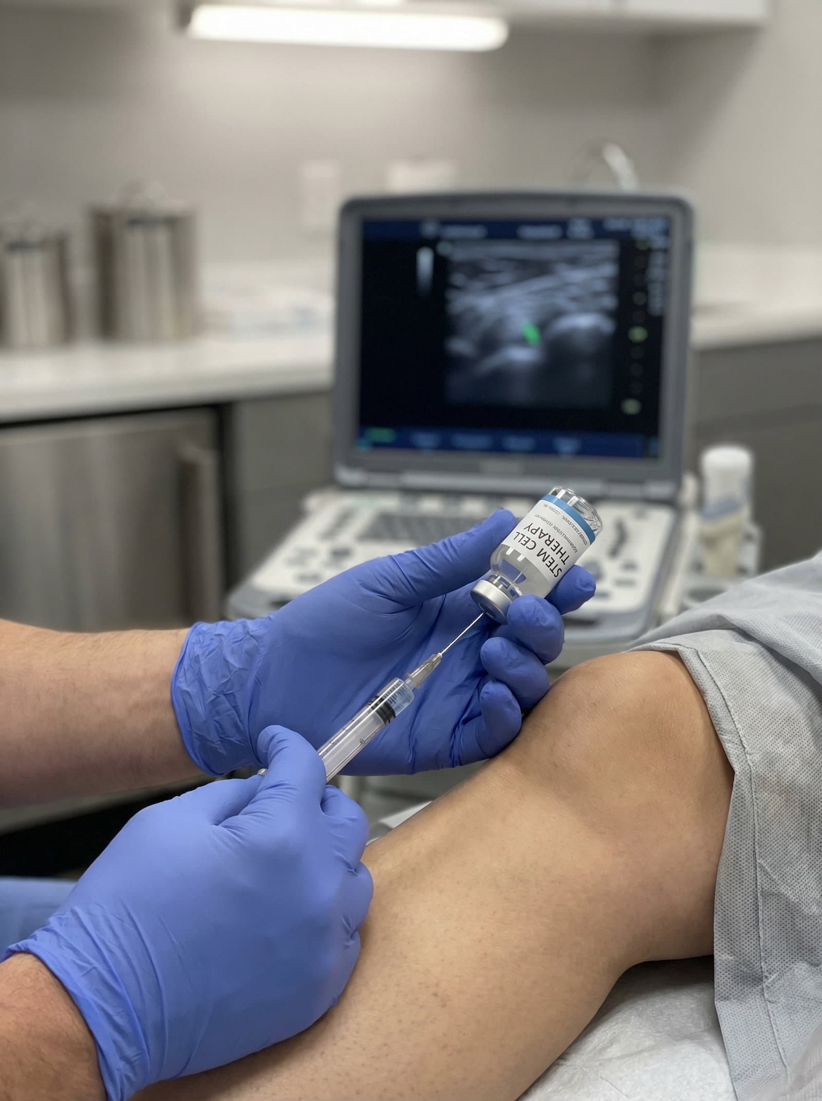 Stem Cell Therapy